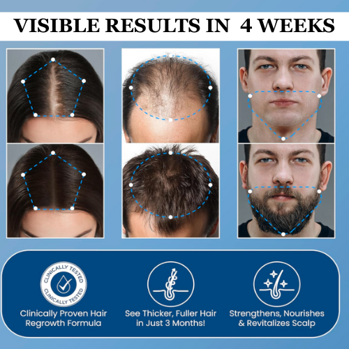 Virexo™ Hair Growth Serum — product details