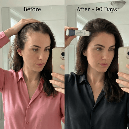Newplum: Advanced Hair Growth Roll-On Serum