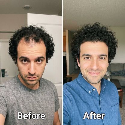 Newplum: Advanced Hair Growth Roll-On Serum