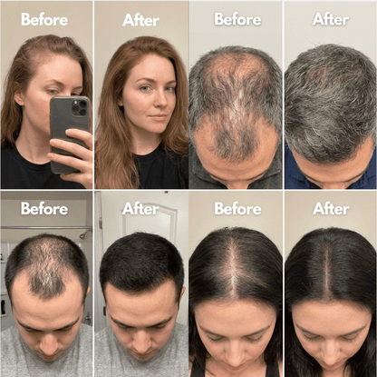 Newplum: Advanced Hair Growth Roll-On Serum